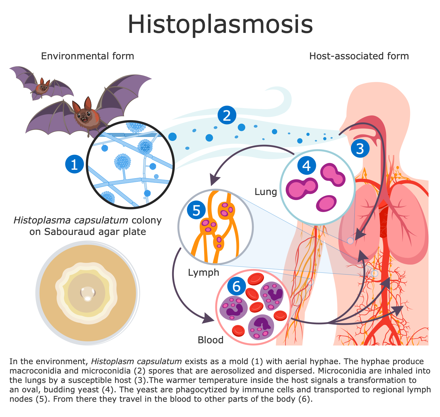 Medical Mycology Infographic - Histoplasma Life Cycle