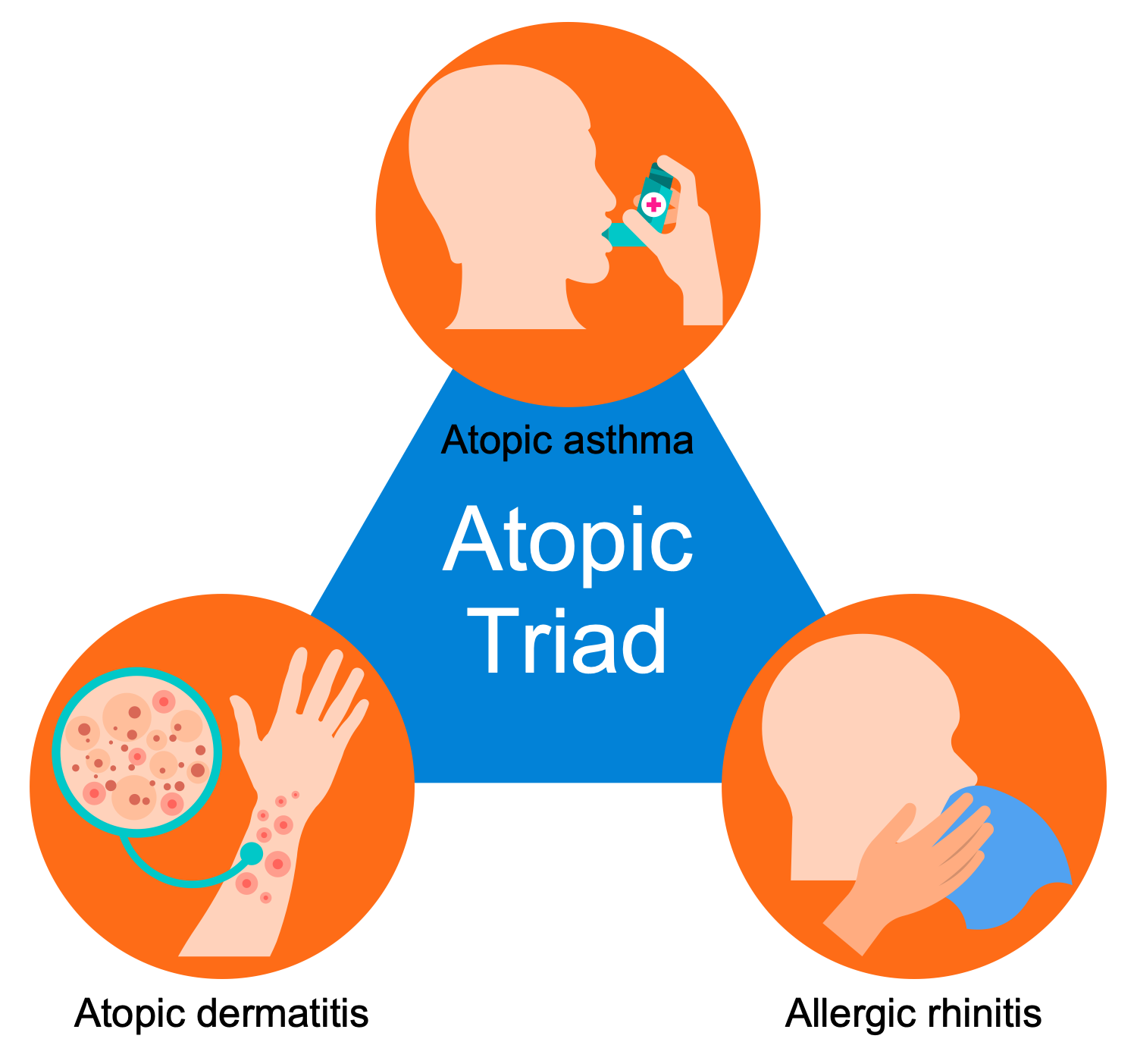 Atopic Triad