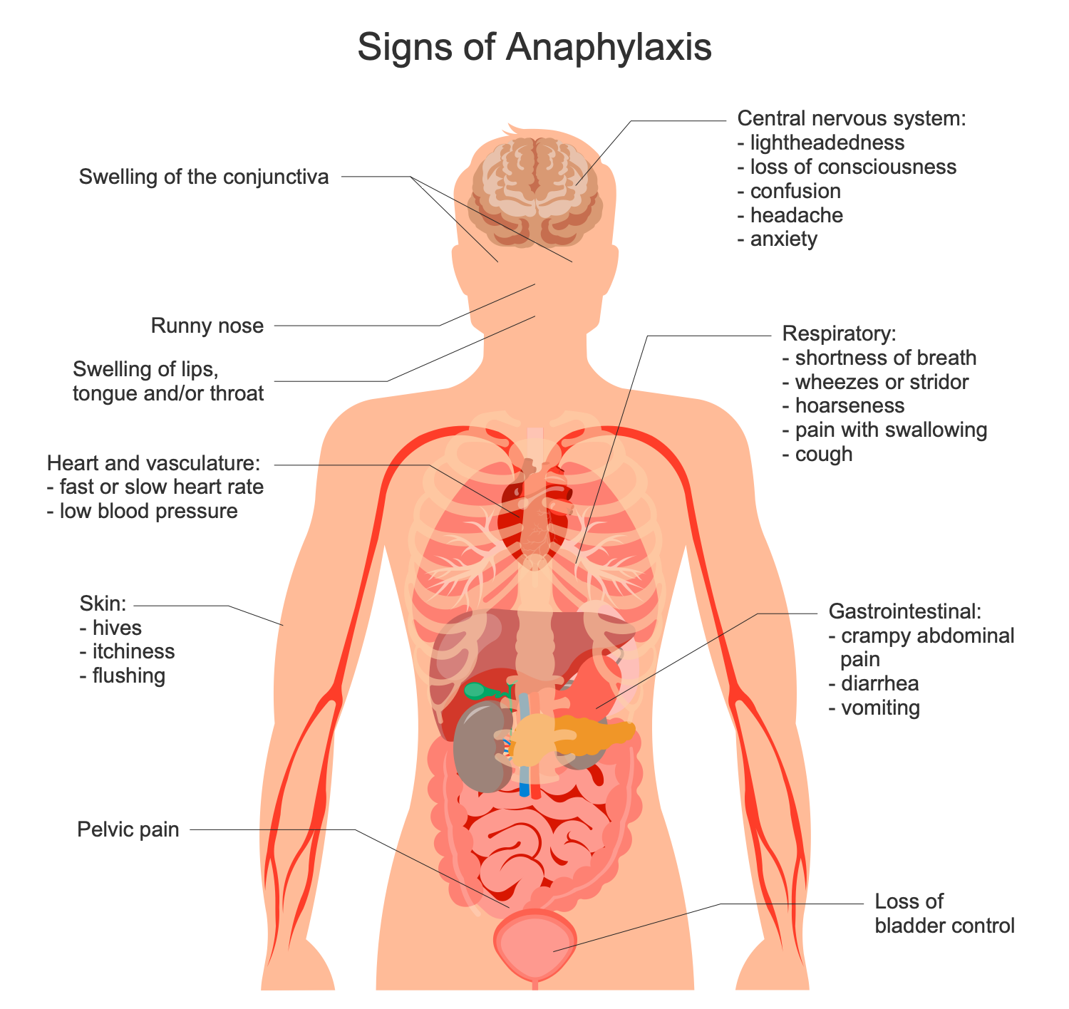 Signs of Anaphylaxis