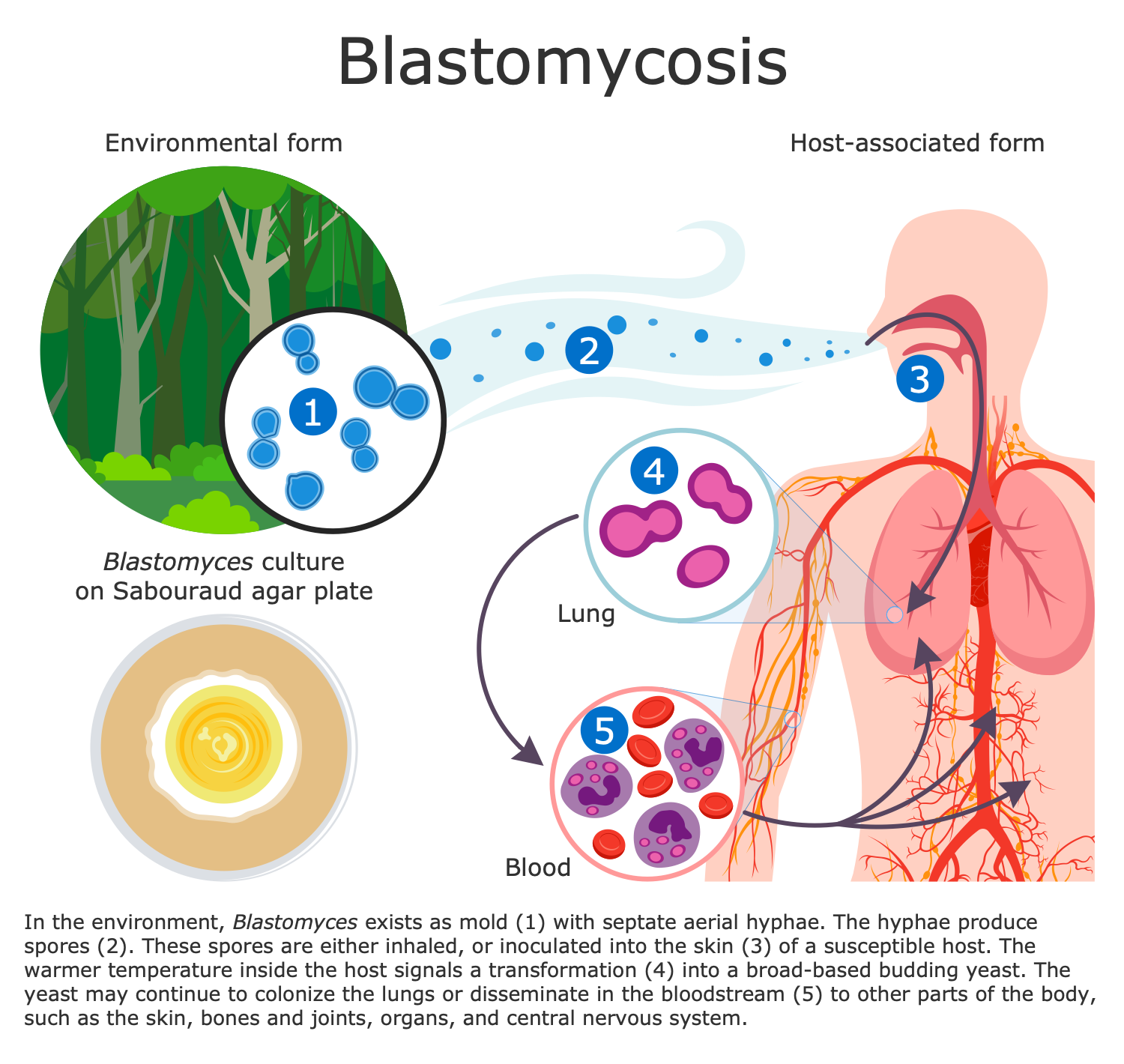 Blastomyces Life Cycle