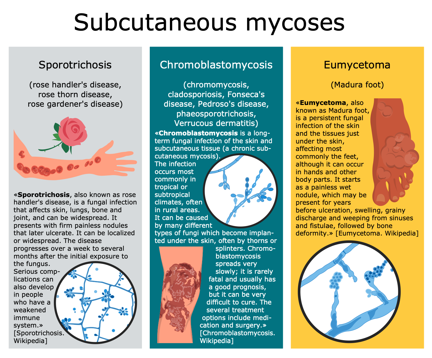 Subcutaneous Mycoses